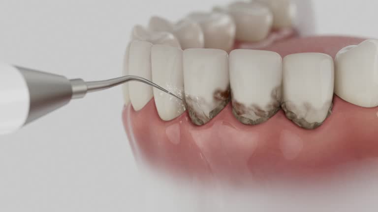 Trusted Dental Implants service in Advance, NC - Dentist Open Now
